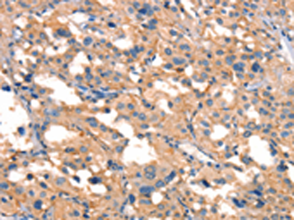 Anti-SMURF1 Rabbit Polyclonal Antibody