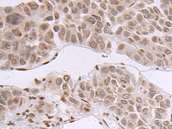 Anti-MAPK13 Rabbit Polyclonal Antibody