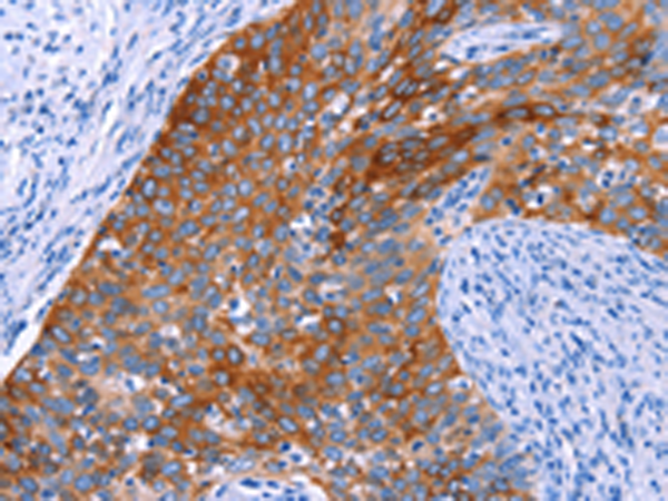 Anti-SGK2 Rabbit Polyclonal Antibody