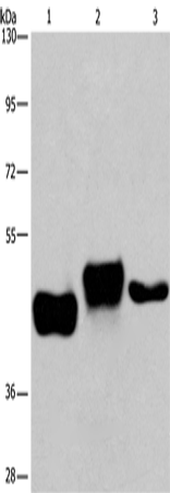 Anti-SGK2 Rabbit Polyclonal Antibody