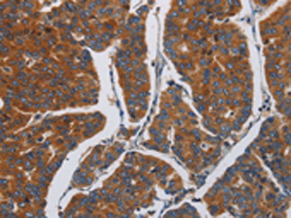 Anti-APEH  Rabbit Polyclonal Antibody