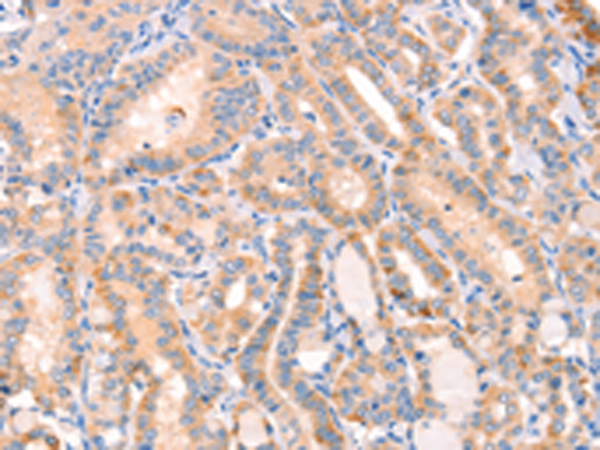 Anti-CD109 Rabbit Polyclonal Antibody