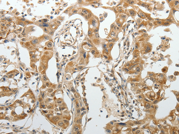 Anti-SPAG4 Rabbit Polyclonal Antibody
