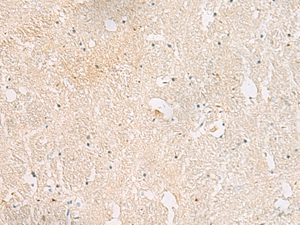 Anti-AKAP3 Rabbit Polyclonal Antibody