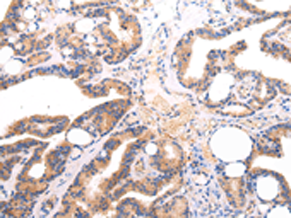 Anti-Lambda Light Chain Rabbit Polyclonal Antibody