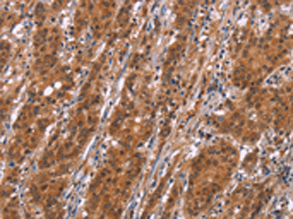 Anti-SLC8A2 Rabbit Polyclonal Antibody