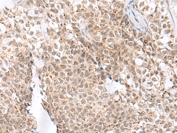 Anti-Notch2 Rabbit Polyclonal Antibody