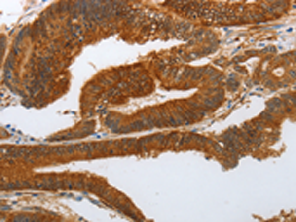 Anti-Notch3 Rabbit Polyclonal Antibody