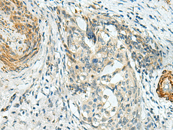 Anti-PLPPR5 Rabbit Polyclonal Antibody