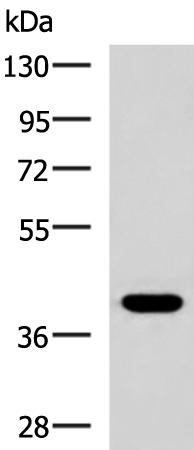 Anti-PLPPR5 Rabbit Polyclonal Antibody