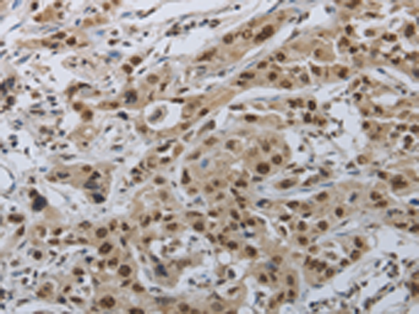 Anti-PKA RI beta Rabbit Polyclonal Antibody