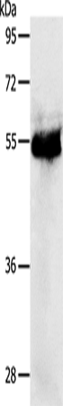 Anti-PKA RI beta Rabbit Polyclonal Antibody