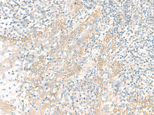 Anti-PSCA Rabbit Polyclonal Antibody