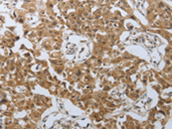 Anti-PSMD6 Rabbit Polyclonal Antibody