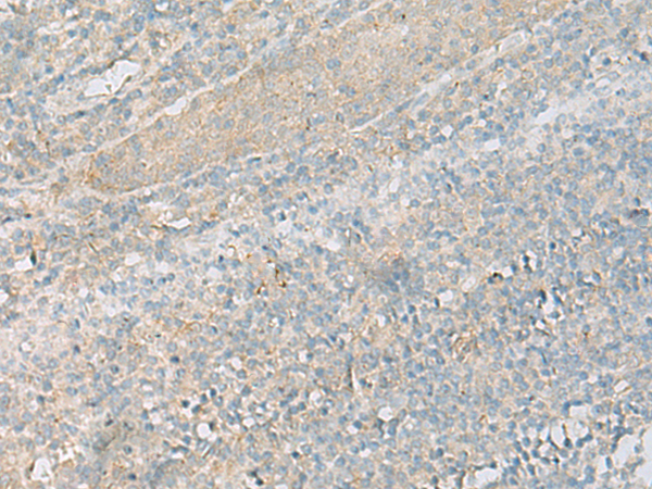 Anti-SCTR Rabbit Polyclonal Antibody