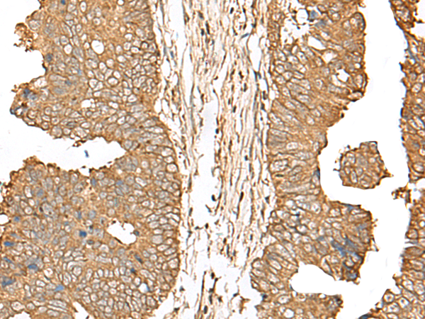 Anti-SGLT1 Rabbit Polyclonal Antibody