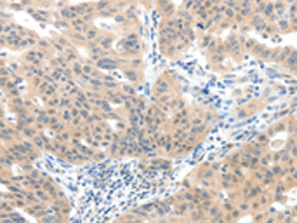 Anti-SLC20A1 Rabbit Polyclonal Antibody