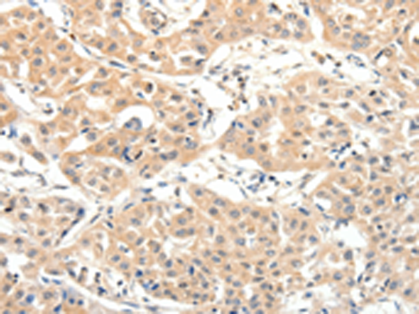 Anti-FATP1 Rabbit Polyclonal Antibody