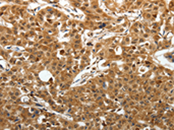 Anti-SOX13 Rabbit Polyclonal Antibody