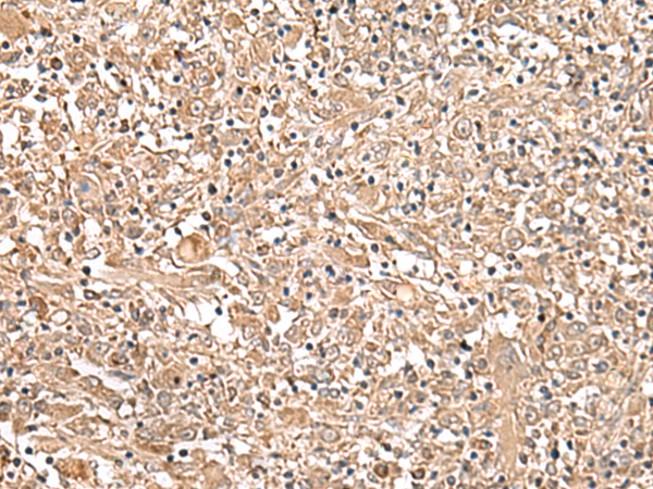 Anti-STEAP4 Rabbit Polyclonal Antibody