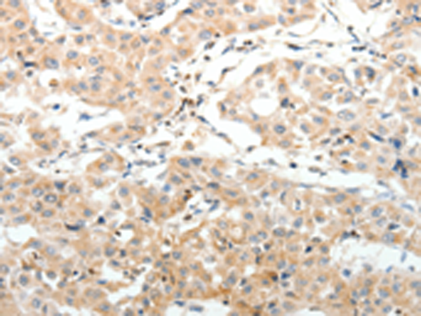 Anti-Synaptic Vesicle Glycoprotein 2A Rabbit Polyclonal Antibody