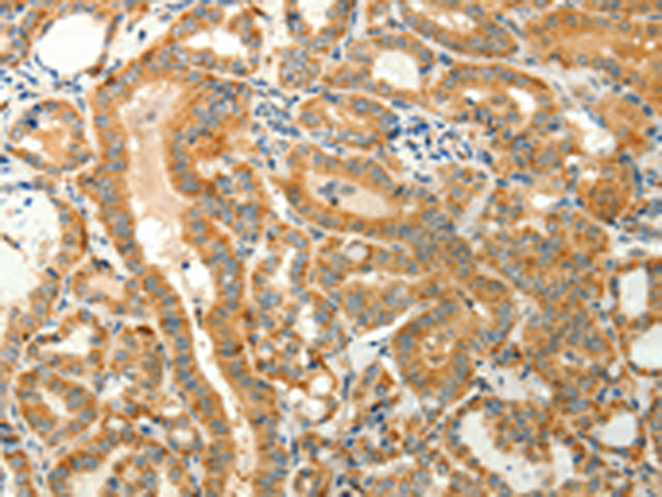 Anti-Thymosin beta 4 Rabbit Polyclonal Antibody