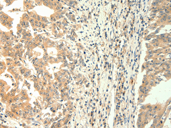 Anti-TRPM5 Rabbit Polyclonal Antibody