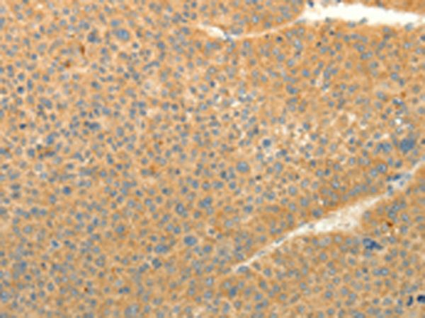 Anti-LPAR3 Rabbit Polyclonal Antibody