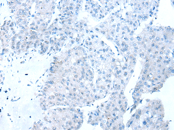 Anti-RBFOX1 Rabbit Polyclonal Antibody
