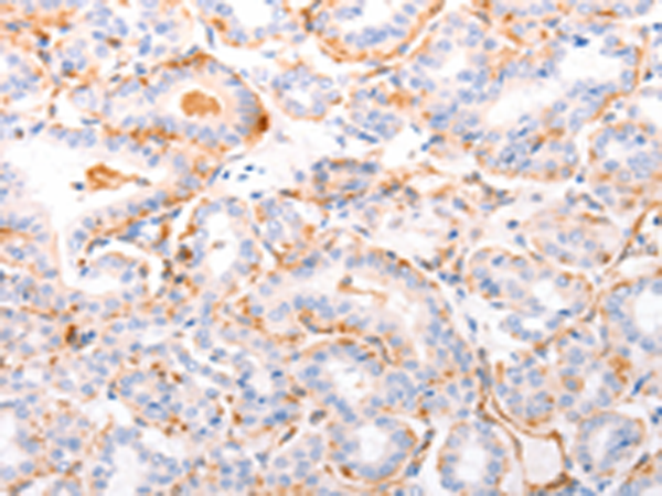 Anti-ABCA4 Rabbit Polyclonal Antibody
