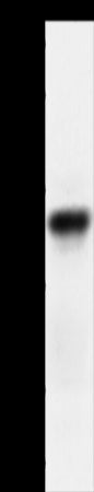 Anti-ACR Rabbit Polyclonal Antibody