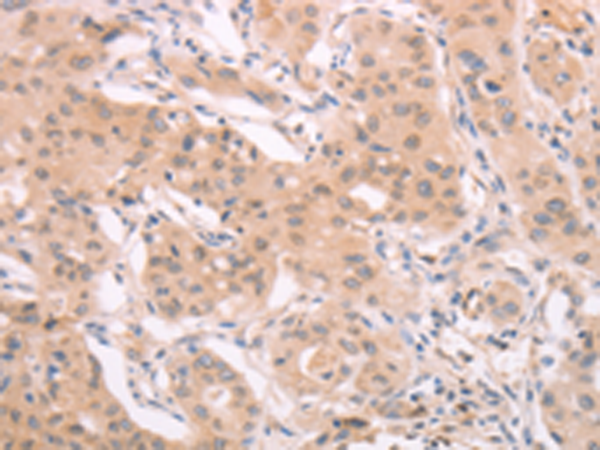 Anti-ADAM11 Rabbit Polyclonal Antibody