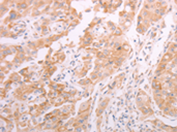 Anti-ADAMTS10 Rabbit Polyclonal Antibody