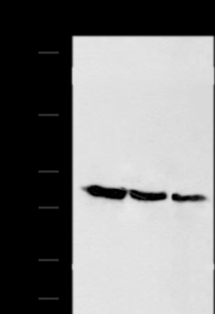 Anti-ADAMTS15 Rabbit Polyclonal Antibody