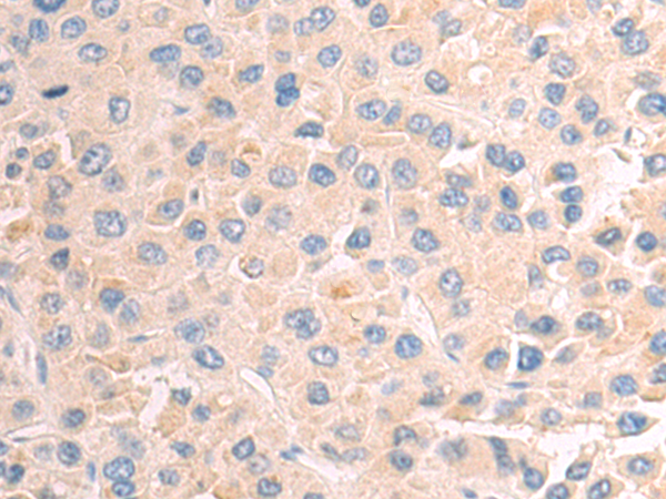 Anti-ADAMTS16 Rabbit Polyclonal Antibody