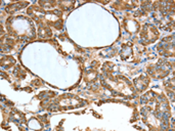 Anti-ALDH9A1 Rabbit Polyclonal Antibody