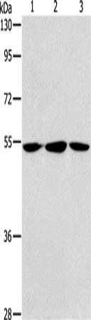 Anti-ALDH9A1 Rabbit Polyclonal Antibody
