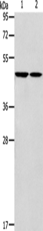 Anti-GLRA1 Rabbit Polyclonal Antibody