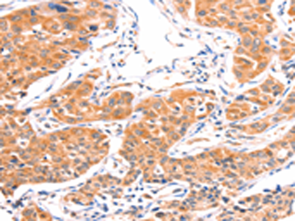 Anti-AMPD1 Rabbit Polyclonal Antibody