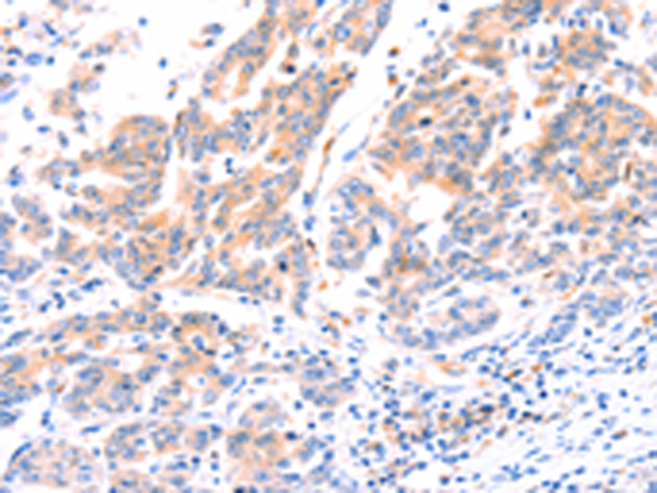 Anti-ANKZF1 Rabbit Polyclonal Antibody