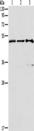 Anti-Transcription Factor AP 2 gamma Rabbit Polyclonal Antibody