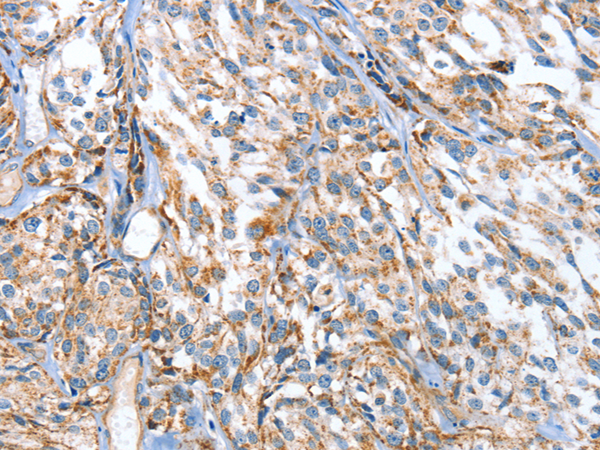 Anti-ApoBEC3D Rabbit Polyclonal Antibody