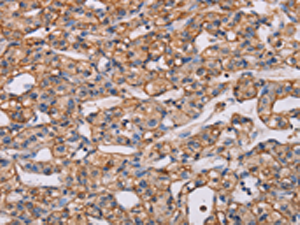 Anti-ARAP1 Rabbit Polyclonal Antibody