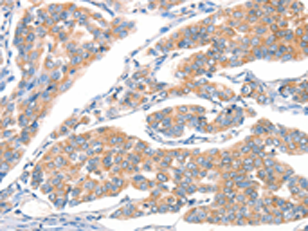 Anti-ART4 Rabbit Polyclonal Antibody