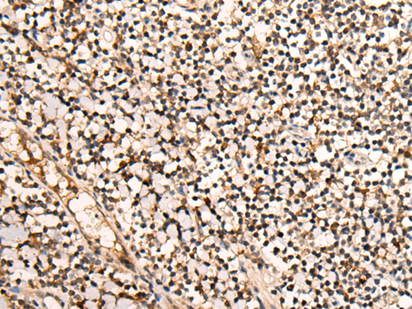 Anti-SENP6 Rabbit Polyclonal Antibody