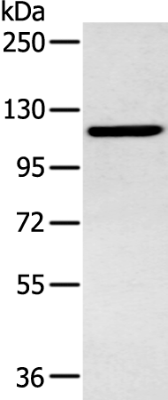 Anti-SENP6 Rabbit Polyclonal Antibody