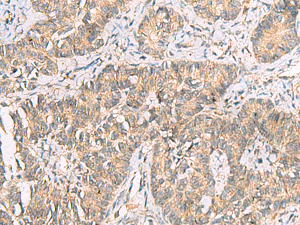 Anti-PIWIL3 Rabbit Polyclonal Antibody