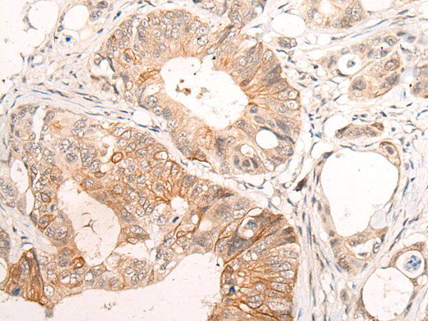 Anti-HTRA1 Rabbit Polyclonal Antibody