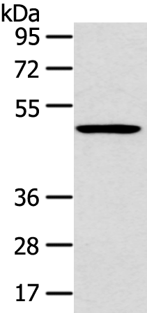 Anti-HTRA1 Rabbit Polyclonal Antibody