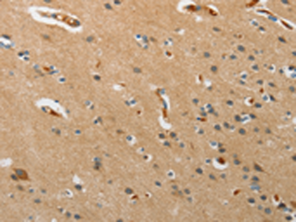 Anti-PITX3 Rabbit Polyclonal Antibody